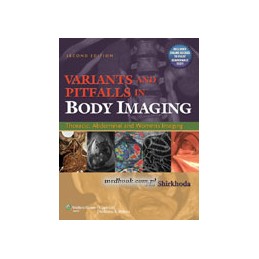Variants and Pitfalls in Body Imaging