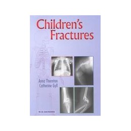 Children's Fractures