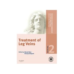 Procedures in Cosmetic Dermatology Series: Treatment of Leg Veins