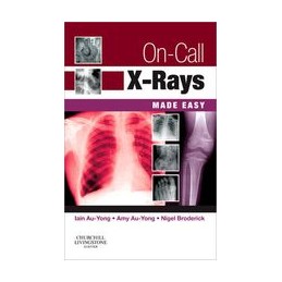 On-Call X-Rays Made Easy