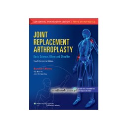 Joint Replacement Arthroplasty