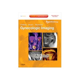 Gynecologic Imaging