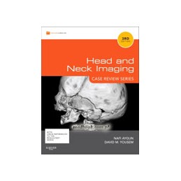 Head and Neck Imaging: Case...