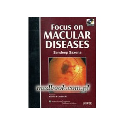 Focus on Macular Diseases