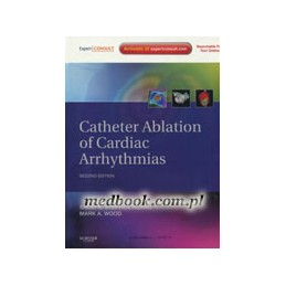 Catheter Ablation of...
