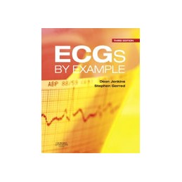 ECGs by Example