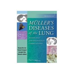 Muller's Diseases of the Lung