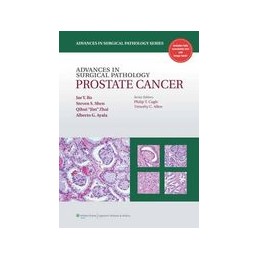 Advances in Surgical Pathology: Prostate Cancer