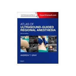 Atlas of Ultrasound-Guided Regional Anesthesia