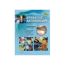 Operative Arthroscopy