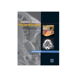Specialty Imaging: Head & Neck Cancer