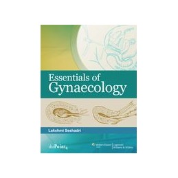 Essentials of Gynaecology