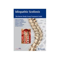 Idiopathic Scoliosis: The...