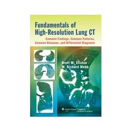 Fundamentals of High-Resolution Lung CT: Common Findings, Common Patterns, Common Diseases, and Differential Diagnosis