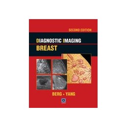 Diagnostic Imaging: Breast, 2nd ed