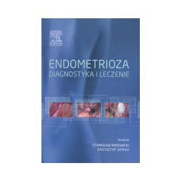 Endometrioza - diagnostyka i leczenie