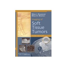 Imaging of Soft Tissue Tumors