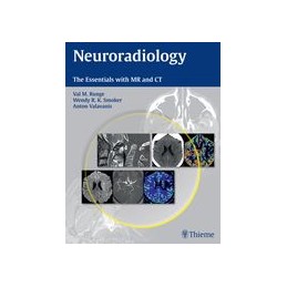 Neuroradiology: The...