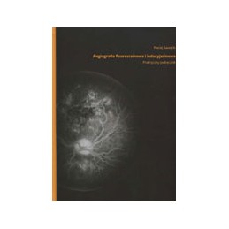 Angiografia fluoresceinowa i indocyjaninowa