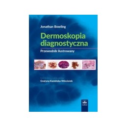 Dermoskopia diagnostyczna
