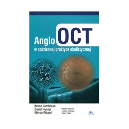 Angio OCT w codziennej praktyce okulistycznej