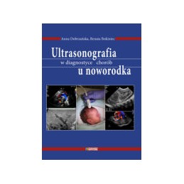 Ultrasonografia w...