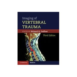 Imaging of Vertebral Trauma