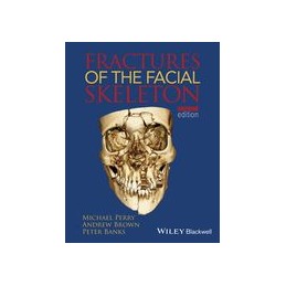 Fractures of the Facial...
