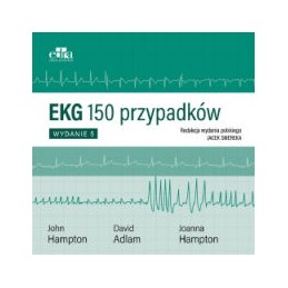 EKG - 150 przypadków