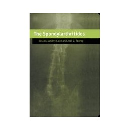 The Spondylarthritides