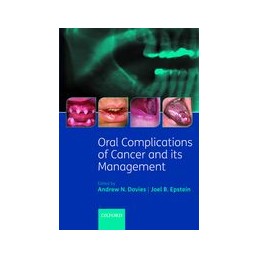 Oral Complications of Cancer and its Management