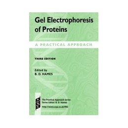 Gel Electrophoresis of Proteins