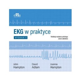 EKG w praktyce