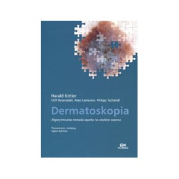 Dermatoskopia