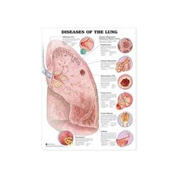 Diseases of the Lung...