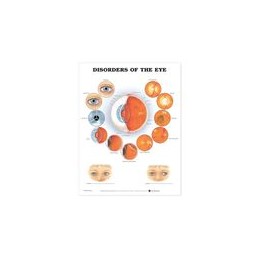 Disorders of the Eye Anatomical Chart