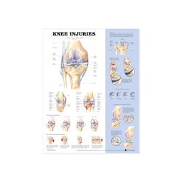 Knee Injuries Anatomical Chart