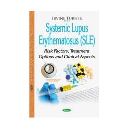 Systemic Lupus Erythematosus (SLE): Risk Factors, Treatment Options & Clinical Aspects