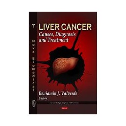 Liver Cancer: Causes,...