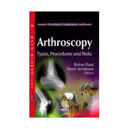 Arthroscopy: Types, Procedures & Risks