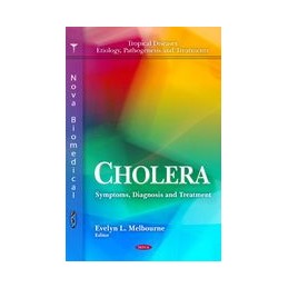 Cholera: Symptoms,...