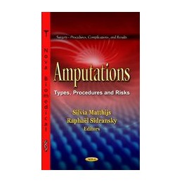 Amputations: Types, Procedures and Risks