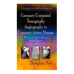 Coronary Computed...