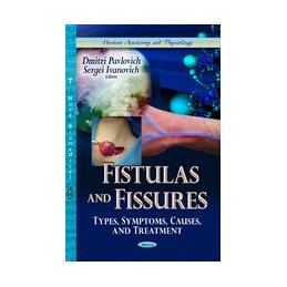 Fistulas & Fissures: Types,...