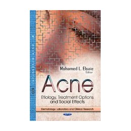 Acne: Etiology, Treatment Options & Social Effects