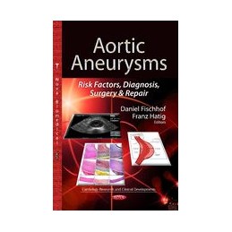 Aortic Aneurysms: Risk...