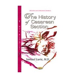 History of Cesarean Section