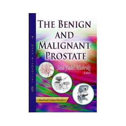 Benign & Malignant Prostate