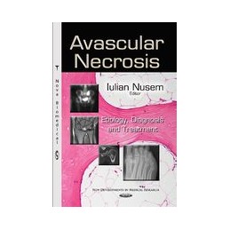 Avascular Necrosis:...