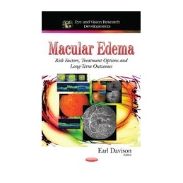 Macular Edema: Risk...